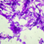 Candida dubliniensis CD36
