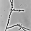 Cladophialophora carrionii CBS 160.54