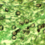 Pneumocystis jirovecii RU7